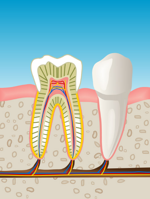 endodoncia en Coslada