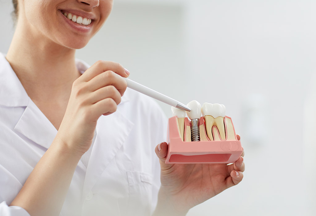 Implantes dentales de carga inmediata en Coslada